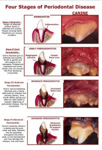 Photos and diagram of periodontal disease