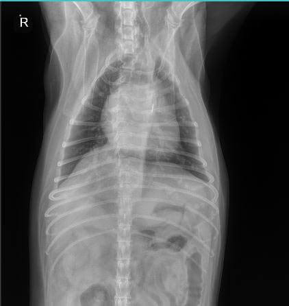 A chest X-ray A chest X-ray